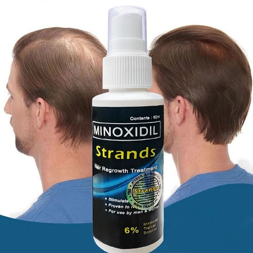 MINOXIDIL Strands Hair Regrowth Treatment